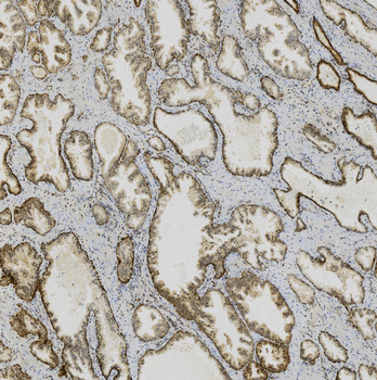 MGMT Antibody