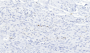 PHOX2B Antibody