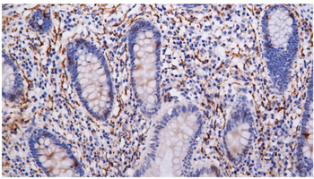 VIP Antibody