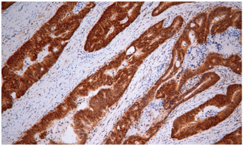 VHL Antibody