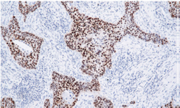 SOX2 Antibody