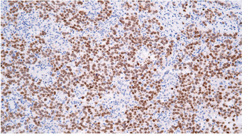 SALL4 Antibody