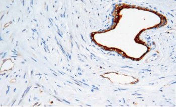 FOLH1 Antibody