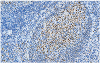 POU2F2 Antibody
