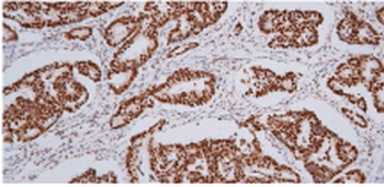 MLH1 Antibody