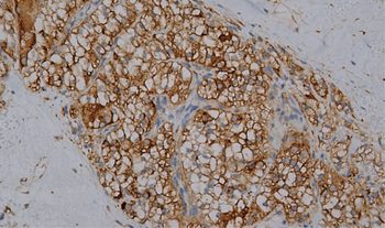 LRP1 Antibody
