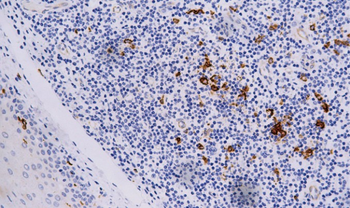 CD207 Antibody