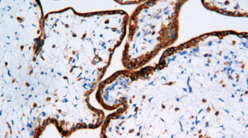 IMP3 Antibody
