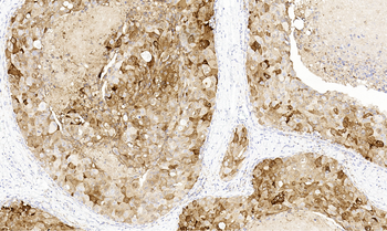 GLUL Antibody