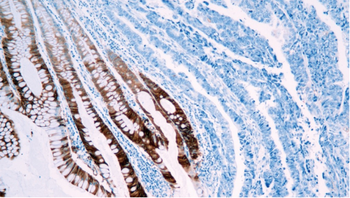 LGALS3 Antibody