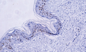 MYC Antibody