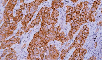 MET Antibody