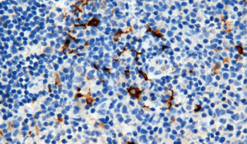 CD163 Antibody
