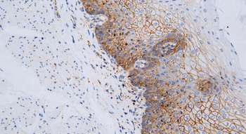 SDC1 Antibody