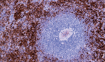 ITGB3 Antibody