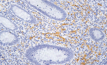 NCAM1 Antibody