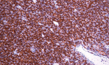 CD4 Antibody