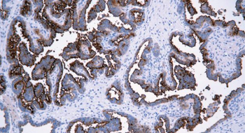 MUC16 Antibody