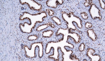AR Antibody