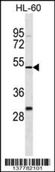 ZNF187 Antibody (N-term)