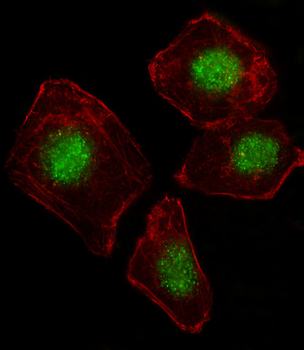 ZNF187 Antibody (N-term)