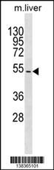 TBX15 Antibody (N-term)
