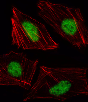 TBX15 Antibody (N-term)