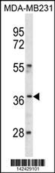 HOXC10 Antibody (C-term)