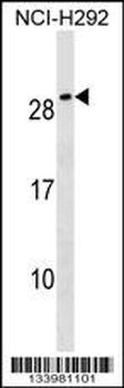 CFC1B Antibody (N-term)