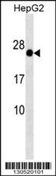 This GAGE12F Antibody