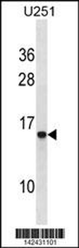HPSE Antibody (Center)