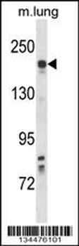Mouse Kdr Antibody (C-term)