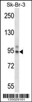 TBX3 Antibody (Center)