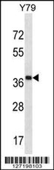 CLIP4 Antibody (Center)