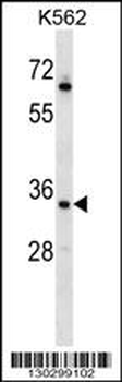 RAD1 Antibody (Center)