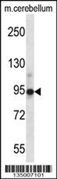 CHRD Antibody (Center)