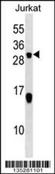 STMN2 Antibody (C-term)