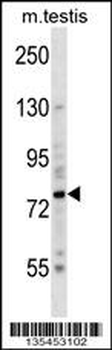 Mouse Brsk2 Antibody (Center)