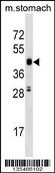 Mouse Cdk18 Antibody (C-term)