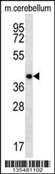 Mouse Hoxd13 Antibody (Center)