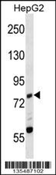 Mouse Zap70 Antibody (C-term)