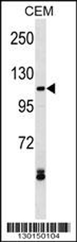 EVI1 Antibody (N-term)