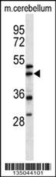 ACTR1A Antibody (Center)