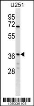 NAPG Antibody (Center)