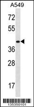HOXD11 Antibody (Center)
