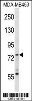 Mouse Syk Antibody (Center)
