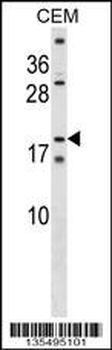 SSX4 Antibody (Center)