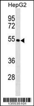 KRT26 Antibody (N-term)