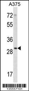 RPLP0 Antibody (N-term)