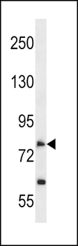 SLC28A2 Antibody (N-term)